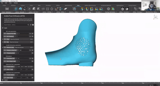 video: Design patient-specific ankle-foot orthoses